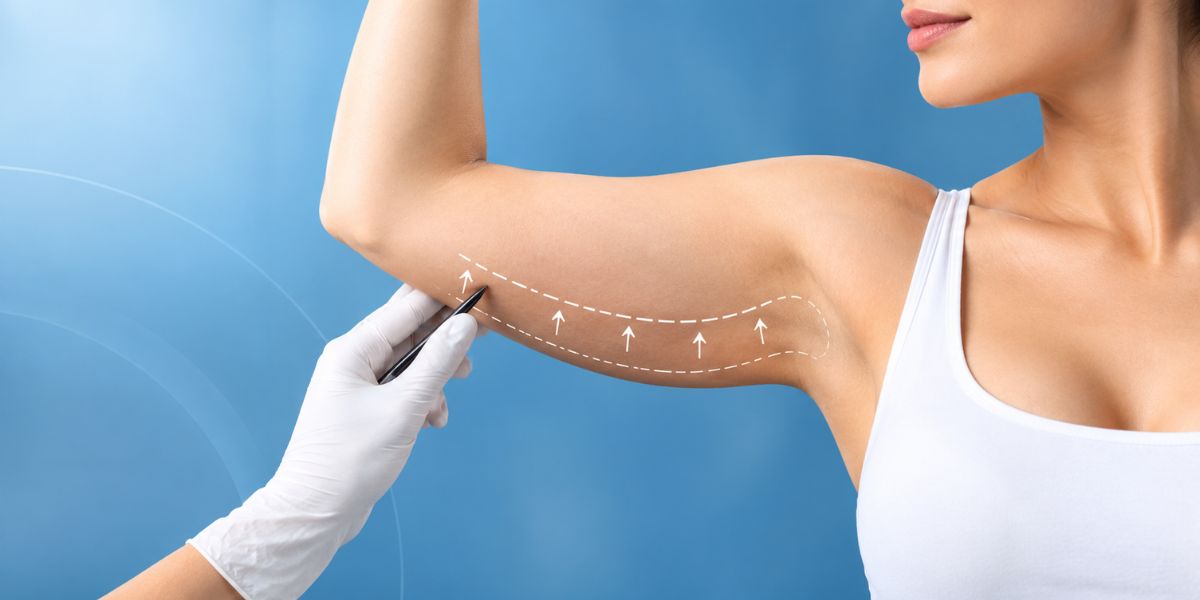Arm Liposuction