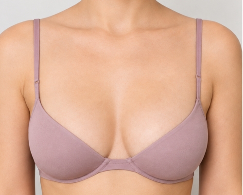 Breast lift before result patient 1
