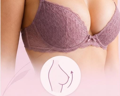 Breast lift treatment