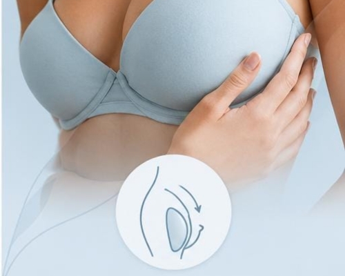 Breast implant revision consultation