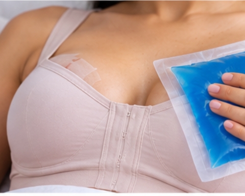 Breast implant revision recovery