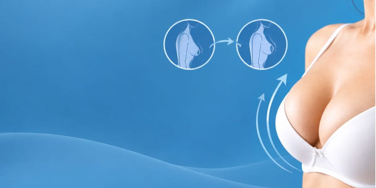 Breast Lift (Mastopexy)