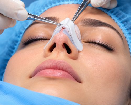 Rhinoplasty nose profile consultation