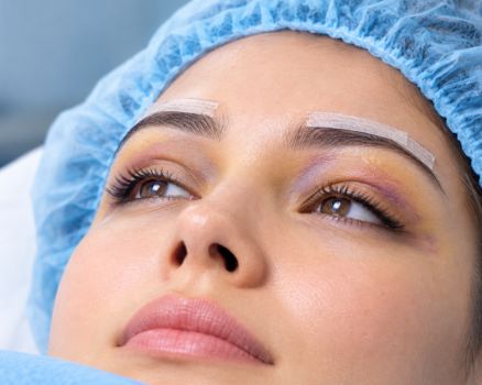Brow lift recovery