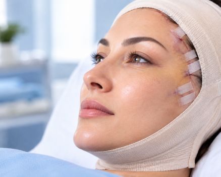 Face lift recovery